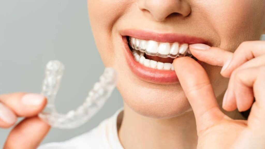 Orthodontic