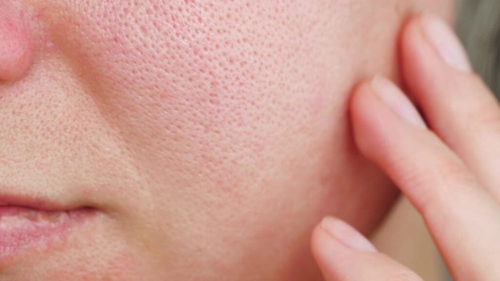 Large Pores