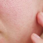 Pore Perfection: Proven Tips to Minimize Large Pores