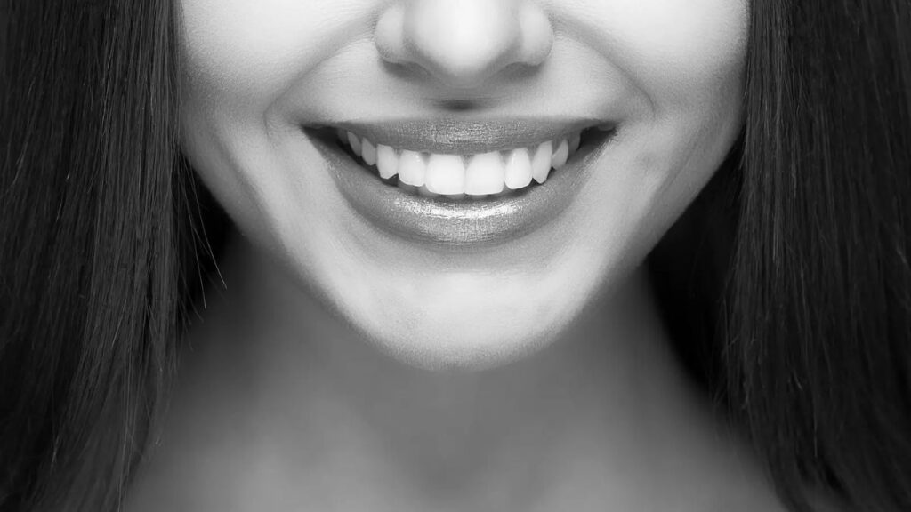 Smile Makeover