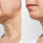 The Science Behind Cellulogia: How It Works and Its Benefits