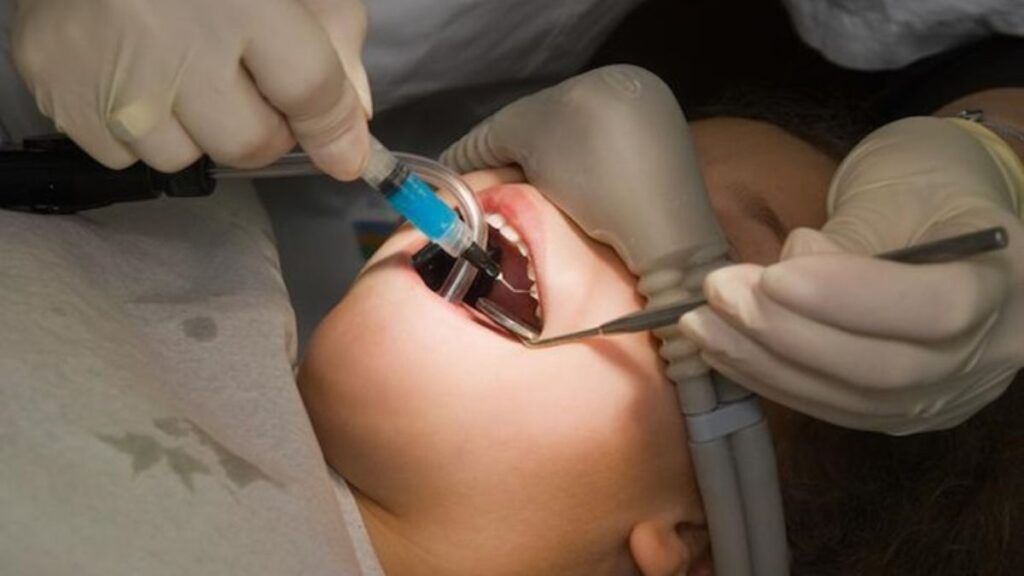 Painless Complex Procedures: How Comfort-Focused Sleep Dentistry Eliminates Fear