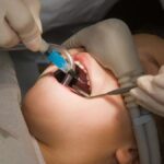 Painless Complex Procedures: How Comfort-Focused Sleep Dentistry Eliminates Fear
