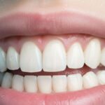 Dentiloquent: Mastering the Art of Effective Communication